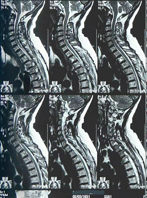 正骨实例1
