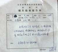 治疗前